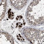 ELMO3 Antibody in Immunohistochemistry (Paraffin) (IHC (P))