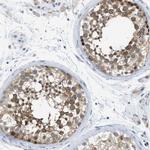 WIPI2 Antibody in Immunohistochemistry (IHC)