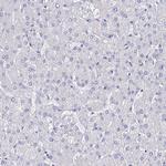 APOBEC3H Antibody in Immunohistochemistry (Paraffin) (IHC (P))