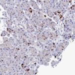 APOBEC3H Antibody in Immunohistochemistry (Paraffin) (IHC (P))