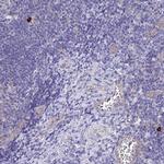 APOBEC3H Antibody in Immunohistochemistry (IHC)