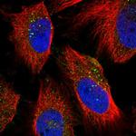 NEU1 Antibody in Immunocytochemistry (ICC/IF)