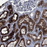 NEU1 Antibody in Immunohistochemistry (Paraffin) (IHC (P))