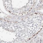 ENASE Antibody in Immunohistochemistry (Paraffin) (IHC (P))