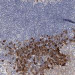 ENASE Antibody in Immunohistochemistry (Paraffin) (IHC (P))