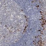 ENASE Antibody in Immunohistochemistry (IHC)