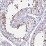 RAB11FIP4 Antibody in Immunohistochemistry (IHC)