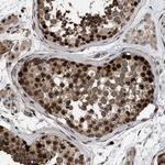 53BP2 Antibody in Immunohistochemistry (Paraffin) (IHC (P))