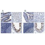 DNAI1 Antibody in Immunohistochemistry (IHC)