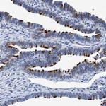 DNAI1 Antibody in Immunohistochemistry (IHC)