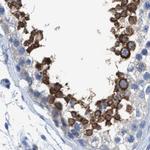 DNAI1 Antibody in Immunohistochemistry (IHC)