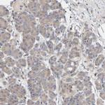 CCM2 Antibody in Immunohistochemistry (IHC)