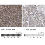 CCM2 Antibody