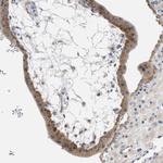 UBAP2 Antibody in Immunohistochemistry (Paraffin) (IHC (P))