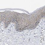 UBAP2 Antibody in Immunohistochemistry (Paraffin) (IHC (P))