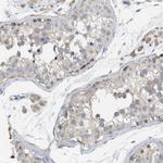 UBAP2 Antibody in Immunohistochemistry (Paraffin) (IHC (P))