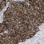 UBAP2 Antibody in Immunohistochemistry (Paraffin) (IHC (P))