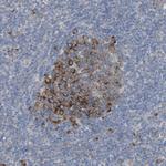 UBAP2 Antibody in Immunohistochemistry (Paraffin) (IHC (P))