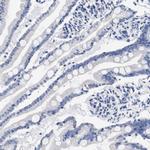 KLHL41 Antibody in Immunohistochemistry (Paraffin) (IHC (P))