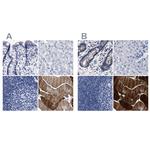 KLHL41 Antibody in Immunohistochemistry (IHC)