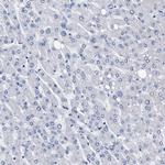 KLHL41 Antibody in Immunohistochemistry (IHC)