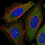 DENR Antibody in Immunocytochemistry (ICC/IF)