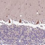 DENR Antibody in Immunohistochemistry (Paraffin) (IHC (P))