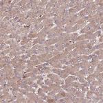 DENR Antibody in Immunohistochemistry (Paraffin) (IHC (P))