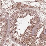 DENR Antibody in Immunohistochemistry (Paraffin) (IHC (P))