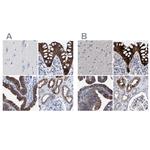 MKS1 Antibody in Immunohistochemistry (IHC)