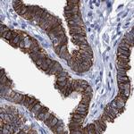 MKS1 Antibody in Immunohistochemistry (IHC)