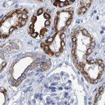 MKS1 Antibody in Immunohistochemistry (IHC)