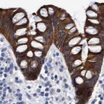 MKS1 Antibody in Immunohistochemistry (IHC)