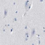 MKS1 Antibody in Immunohistochemistry (IHC)