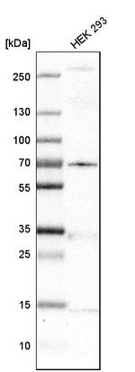 MKS1 Antibody in Western Blot (WB)