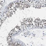 Parg Antibody in Immunohistochemistry (IHC)