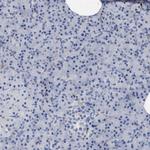 HS3ST5 Antibody in Immunohistochemistry (Paraffin) (IHC (P))