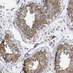 HS3ST5 Antibody in Immunohistochemistry (Paraffin) (IHC (P))