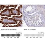 HSD17B2 Antibody in Immunohistochemistry (IHC)