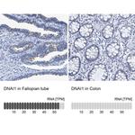 DNAI1 Antibody in Immunohistochemistry (IHC)