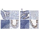 DNAI1 Antibody in Immunohistochemistry (IHC)