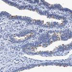 DNAI1 Antibody in Immunohistochemistry (IHC)