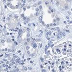 DNAI1 Antibody in Immunohistochemistry (IHC)