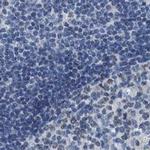 DNAI1 Antibody in Immunohistochemistry (IHC)