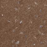 LRSAM1 Antibody in Immunohistochemistry (Paraffin) (IHC (P))