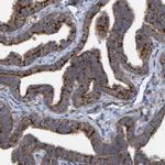 LRSAM1 Antibody in Immunohistochemistry (Paraffin) (IHC (P))