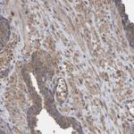 LRSAM1 Antibody in Immunohistochemistry (Paraffin) (IHC (P))