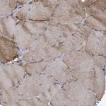 LRSAM1 Antibody in Immunohistochemistry (Paraffin) (IHC (P))