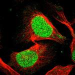 eIF4A3 Antibody in Immunocytochemistry (ICC/IF)