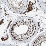 PRPSAP2 Antibody in Immunohistochemistry (Paraffin) (IHC (P))